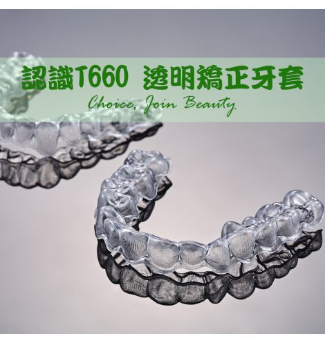 認識 T660 透明牙套