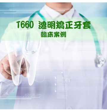T660透明矯正牙套臨床案例