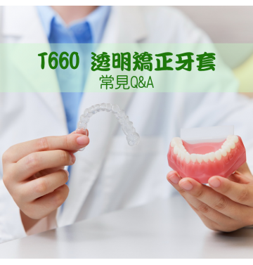 T660 透明矯正牙套常見Q&A