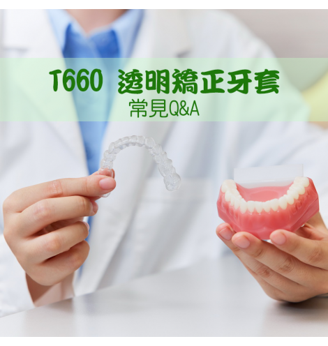 T660 透明矯正牙套常見Q&A