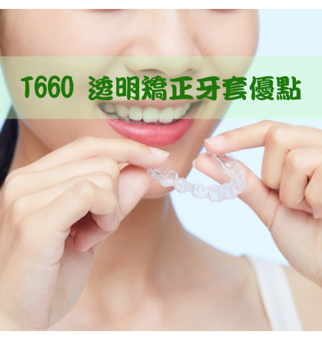 T660 透明矯正牙套優點