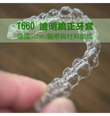 T660 透明矯正牙套  │ 德國Scheu醫療級材料製成