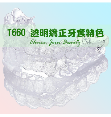 T660 透明矯正牙套特色