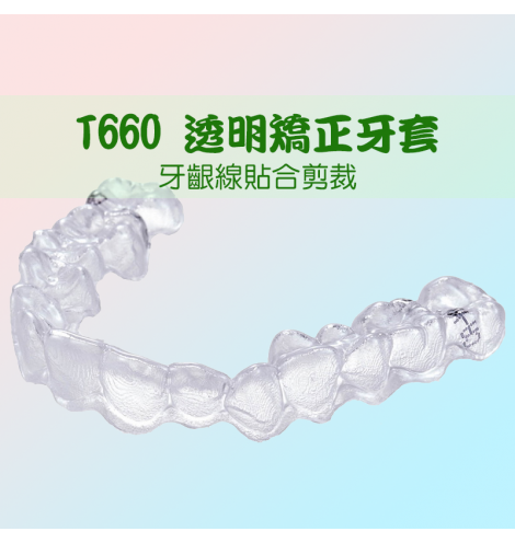 T660 透明矯正牙套 ▏牙齦線貼合剪裁 完美包覆 效率、舒適度再升級